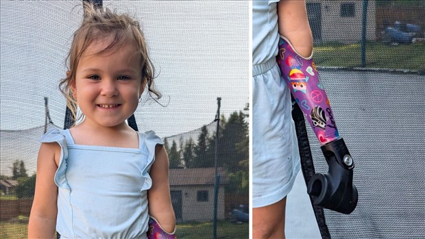 Une Georgienne de 4 ans reçoit une prothèse pour faire du vélo